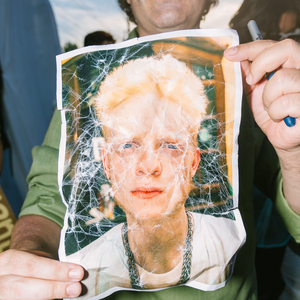 后仰式口爆喉咙最快恢复方法
